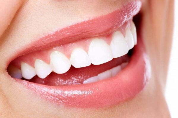 Guarding Your Smile The Importance Of Gum Line Health Guarding Your Smile: The Importance Of Gum Line Health