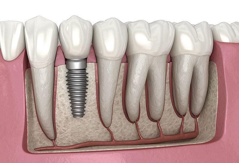 Grow Gums Back Naturally