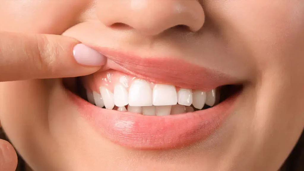 importance of gum line health