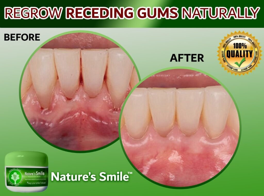 Natural Cure To Regrow Gums